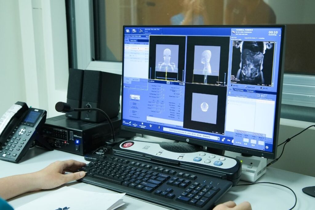 Tầm soát đột quỵ