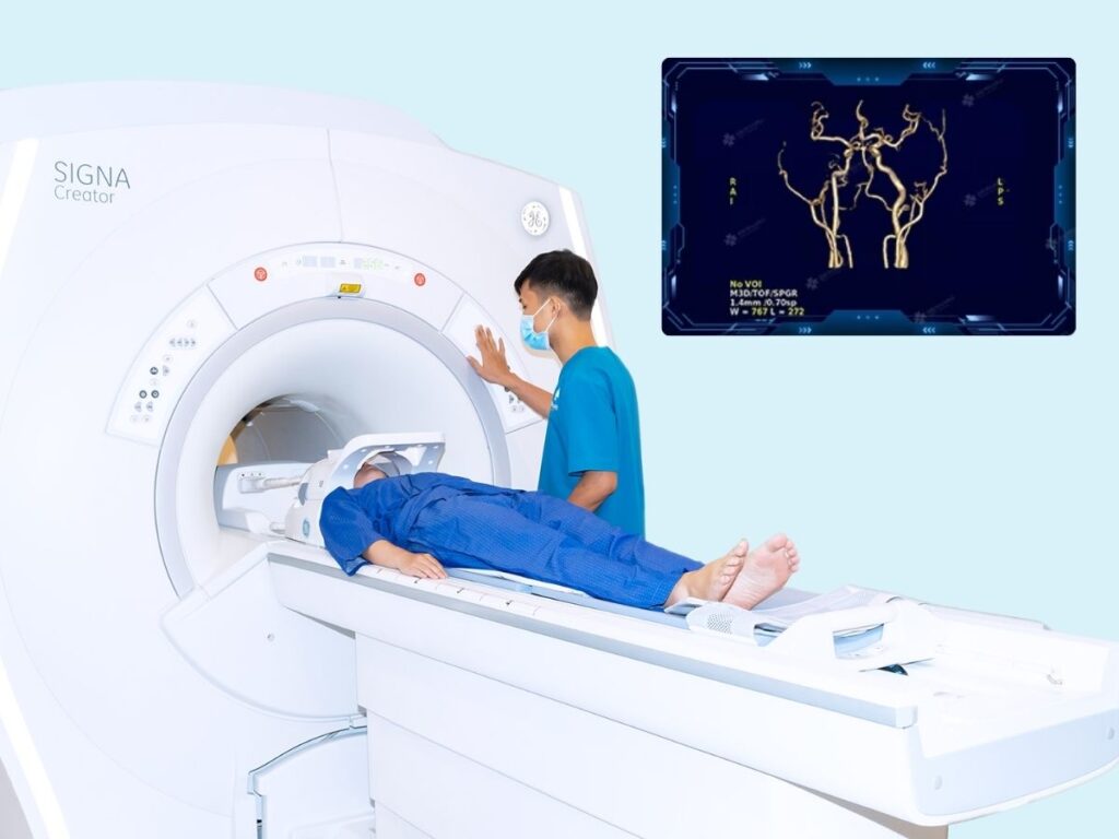 Tầm soát đột quỵ